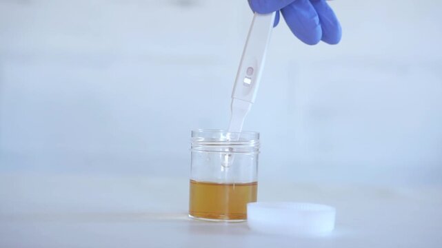 Medical scientist holding Urine pregnancy test with urine sample concept