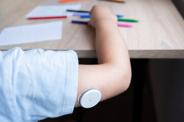 Child drawing with continuous glucose monitoring system sensor on arm