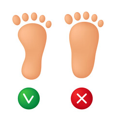 Healthy foot and flatfoot. Vector illustration isolated on white background.