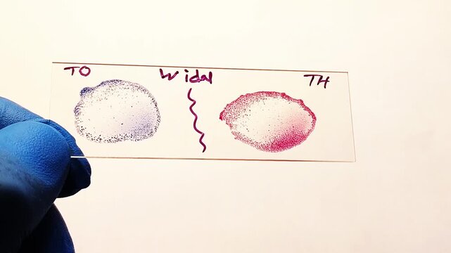 Test for Salmonella typhi and salmonella parratyphi, positive TO, TH result mean positive for salmonella typhi.