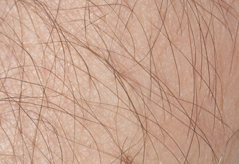 Hair close-up.Phototrichogram and trichogram.Hair extensions.Depilation.