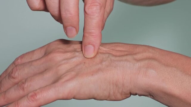 Conducting a skin dryness test. Thin, dry skin on the hands. A woman pinches the skin on the back of her hand and checks it. Veins and pigment spots are visible. The concept of cosmetology.