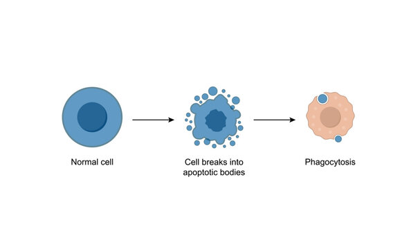 Apoptosis. Programmed cell death. Aging process in cells. Stages of apoptosis, normal cell, shrinkage, membrane blebbing, cell breaks into apoptotic bodies and phagocytosis. Vector illustration.