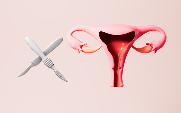 Human uterus and surgical tools, uterine surgery, 3d rendering.