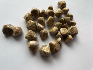 stones extracted from a human gallbladder