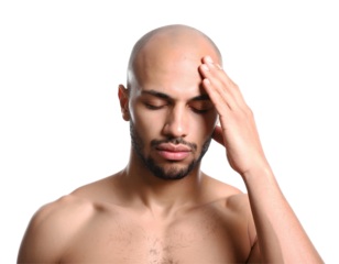 Bald man touching his head with eyes closed, expressing stress, pain, or fatigue. Isolated on transparent background, concept of headache or emotional struggle