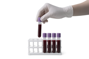 Gloved hand placing blood vial into rack with others, blood test with vial and transparent background