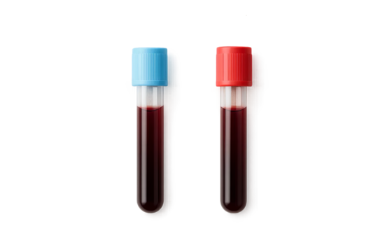 Two filled blood vials with red and blue caps side by side, blood test with vial and transparent background - Powered by Adobe