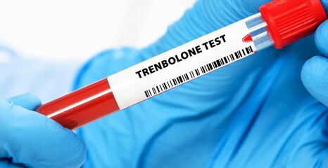 Naklejka premium Trenbolone Test