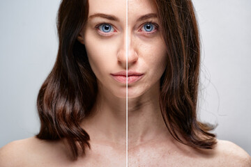 Comparison of Skin Before and After Cosmetic Enhancement Treatment