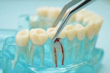 Teeth dental model with tool for dentist use to cleaning care treatment.