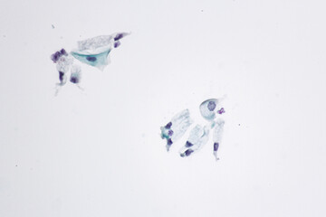 View in microscopic of normal human cervix cells.Glandular epithelial cells shows columnar structure and cilia from pap smear cervixl and vaginal woman.Cervical cancer screening test.
