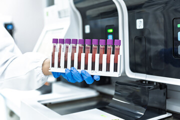 Close up scientist hand wear blue gloves holding blood test tubes with automatic machine in laboratory.Researcher analysis blood chemistry in medical laboratory. Medical healthcare technology research
