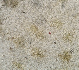 Bananenschale unter dem Mikroskop – Hellfeld, 10-fache Vergrößerung, mit Raphiden