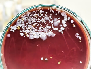 Gloved medical or scientific hand, with a microbiological culture of Candida colony an antimicrobial resistant pathogen.