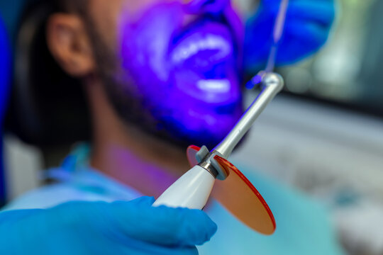 Female Dentist Using Curing Light During Dental Treatment
