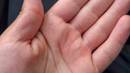 Close-up of a human hand palm, showcasing skin texture and lines. The image highlights the natural...