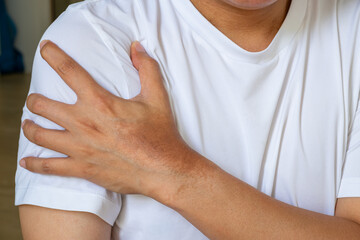 Man in white t-shirt shows upper arm pain from lifting at home, suggesting muscle strain—ideal for orthopedic or physiotherapy ads.