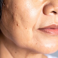 Mature woman's face, wrinkles, and skin imperfections