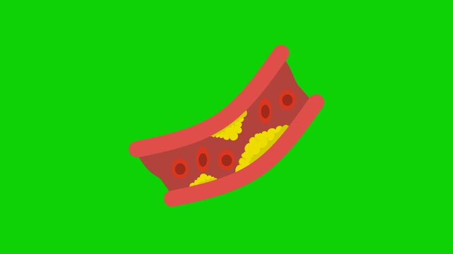 animation of clogged blood vessels, cholesterol and fat deposits on a green background