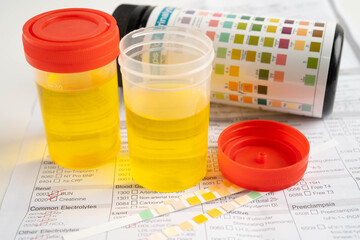 Urinalysis, urine cup with reagent strip pH paper test and comparison chart in laboratory.