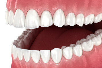 Dental anatomy, 3D illustration