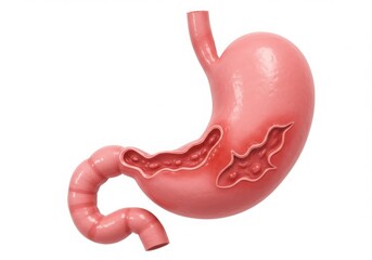 Obraz premium Human stomach anatomy with ulcers isolated on white background