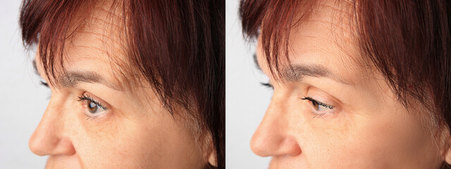 Ageing. Photos of woman's face, closeup. Collage showing difference in skin texture