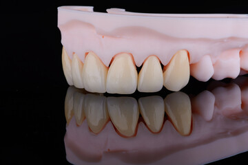High-quality eight dental crowns made of zirconium for fixation to the frontal teeth of upper jaw.