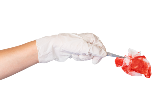 Gloved hand using tweezers to hold a red gauze