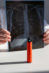 Doctor holding x-ray of lungs with vape in background. 
