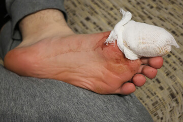 Close-up of a bandaged male leg.