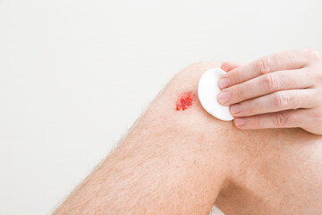 Young adult man hand fingers using white cotton pad and cleaning bleeding red abrasion knee skin after fell down. First aid. Self help. Isolated on light gray wall background. Closeup. Front view.