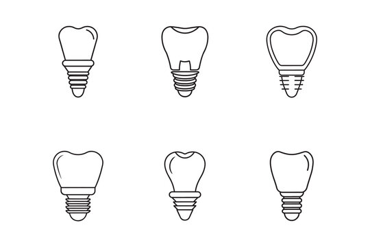 Dental Implant Illustrations Showcase Modern Dentistry and Oral Health Solutions for Tooth Replacement Options