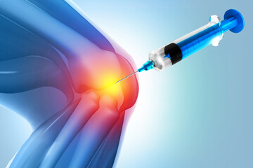 Anatomy Human Knee Joint Treatment, Osteoarthritis Injection, Drug Method Injection, knee injury, 3d illustration