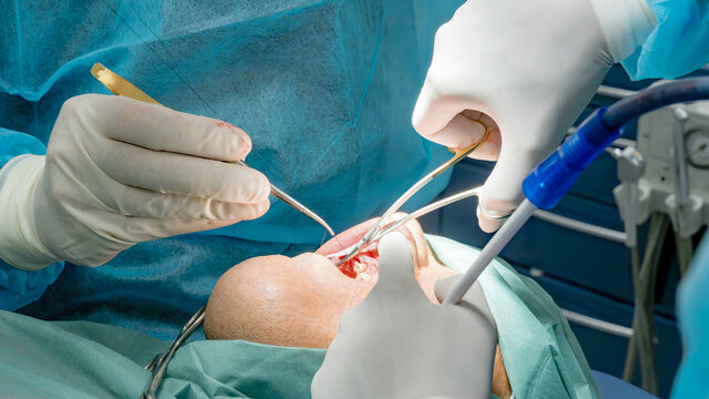 A detailed view of a dental implant procedure