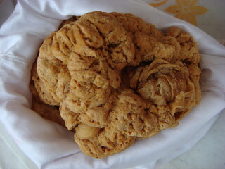 Placenta hominis, a traditional human-derived remedy used for blood enrichment, vitality restoration, and immune support. Privately owned specimen.