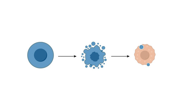 Apoptosis. Programmed cell death. Aging process in cells. Stages of apoptosis, normal cell, shrinkage, membrane blebbing, cell breaks into apoptotic bodies and phagocytosis. Vector illustration.