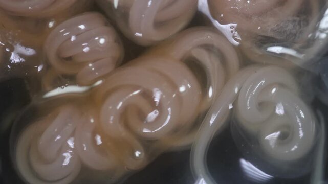 The nematodes (Nematoda), roundworms or eelworms constitute the phylum Nematoda. Species in the phylum inhabit a broad range of environments. Found in freshwater crabs.