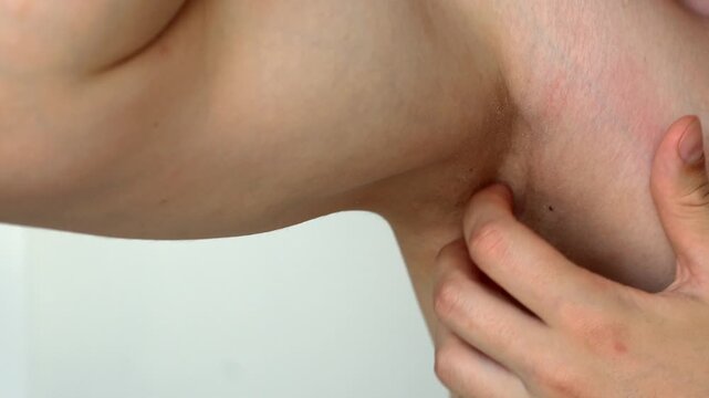 Itching armpit close-up.
Man scratches armpit after shaving because of severe irritation.
Problems and irritation of the code close-up.
Itching on the body