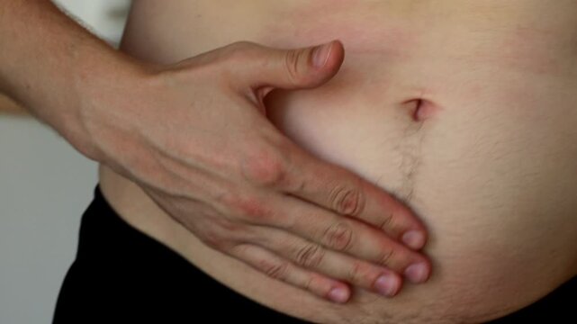 Excess weight in a person due to a passive lifestyle and folds on the stomach.
Fat and cellulite on the body of a person.
Big belly due to diabetes.
Obesity due to health problems
