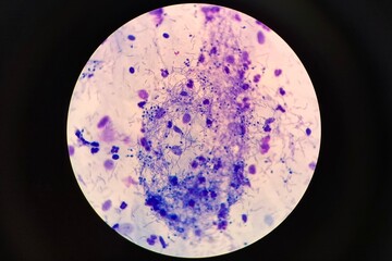 Microscopic view of fungal spores observed in a urogenital smear. The spores appear oval or round and may be seen individually or in clusters. 