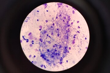 Microscopic view of fungal spores observed in a urogenital smear. The spores appear oval or round and may be seen individually or in clusters. 