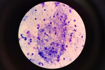 Microscopic view of fungal spores observed in a urogenital smear. The spores appear oval or round and may be seen individually or in clusters. 