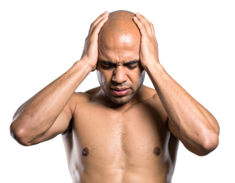  Bald Man Gripping Both Sides of Head in Pain, Tilted Head, Side View, Isolated Transparent Background PNG