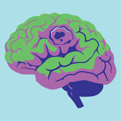 Stylized illustration of a human brain with a malignant tumor. Medical vector graphic for neurology and oncology concepts.