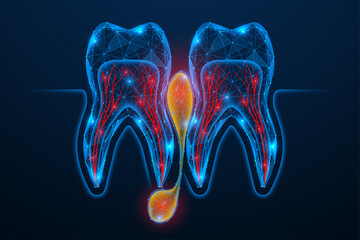 Purulent inflammation of the tooth root. Two teeth in an incision with detailed nerve channels and vessels, as well as a focus of inflammation. A low-poly design made of interconnected elements.