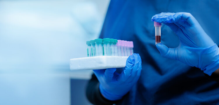 Banner Veterinary clinic laboratory, blood sample analysis by gloved technician - Powered by Adobe