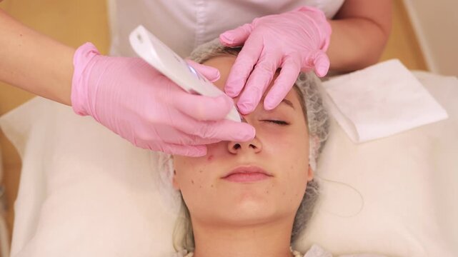 Professional dermatologist performing cosmetic procedure using specialized device for birthmark removal on young girl face in medical spa setting