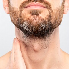 Obraz premium Close-up Portrait of Man Checking Lymph Nodes in Neck, Health Awareness